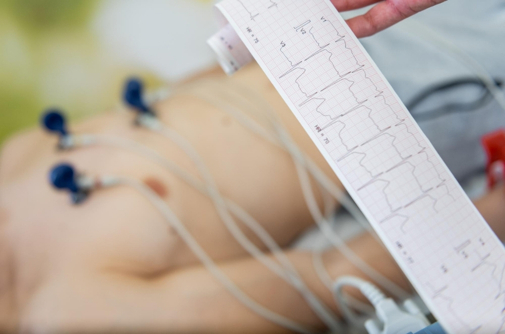 ECG-Test
