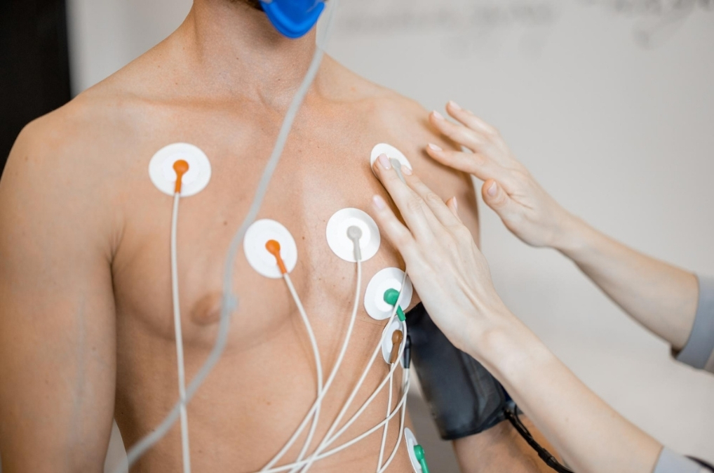 Holter-Monitoring